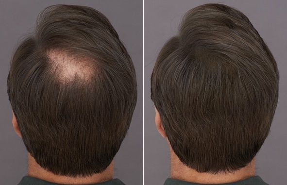 Poudre Capillaire Densifiante – Cheveux plus épais et naturels instantanément