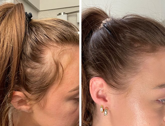 Poudre Capillaire Densifiante – Cheveux plus épais et naturels instantanément